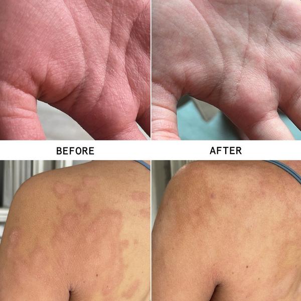 Hypothesis Soothe + Repair Duo #2