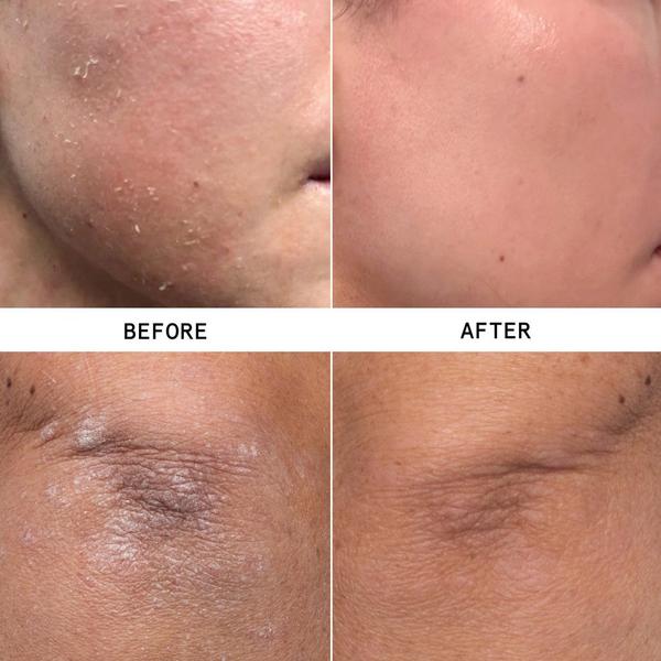 Hypothesis Soothe + Repair Duo #3