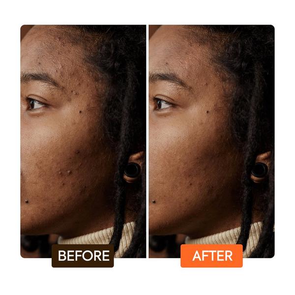 Makari Extreme Argan & Carrot Oil Dark Spot Corrector Serum #5