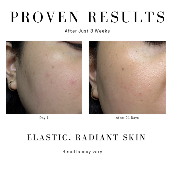 Saint Jane Rich Rescue Phyto Mucin Cream #5