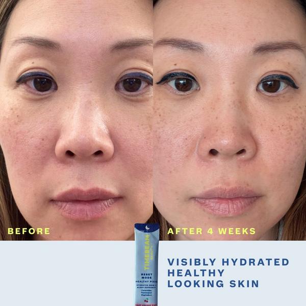 Timebeam Reset Mode Healthy Pixie - Sleep & Skin Supplement #3