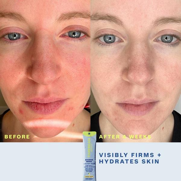 Timebeam Bounce Mode Healthy Pixie - NAD+ Boosting Daily Supplement #3