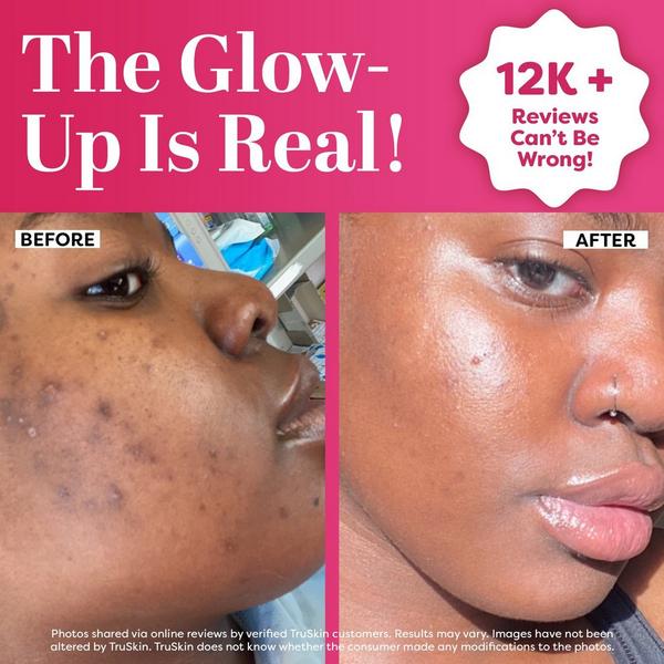 TruSkin Vitamin C Super Serum #3