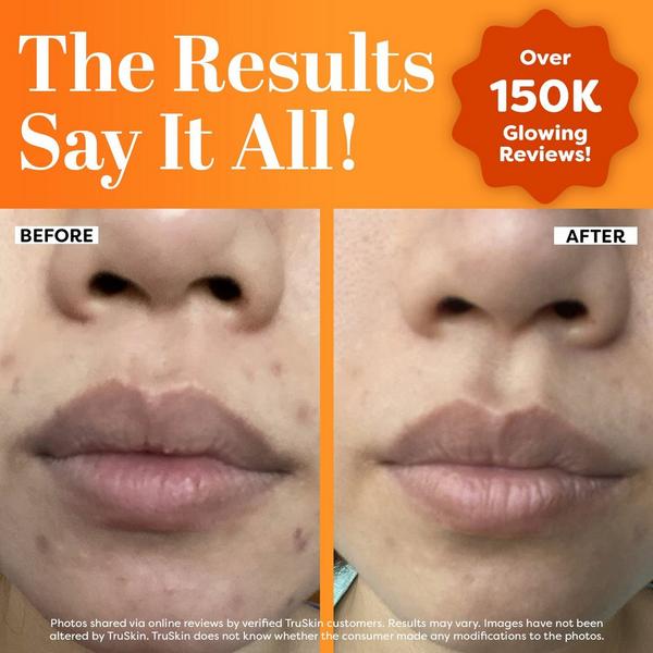 TruSkin Vitamin C Serum #3