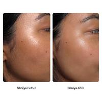 Nimbi Skin Renewal Dermaplaner Starter Bundle #9