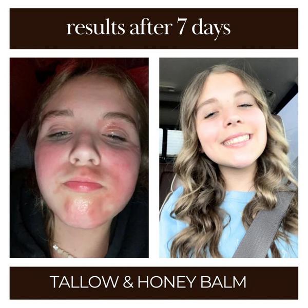 Tallow Me Pretty Tallow & Honey Balm #4