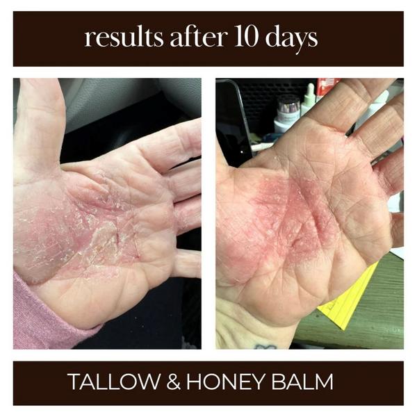 Tallow Me Pretty Tallow & Honey Balm #6