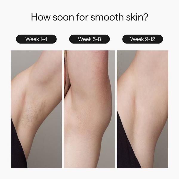 Ulike Air3 IPL Hair Removal Device #3