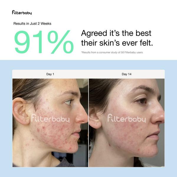 FilterBaby Skincare Water Filter 2.0 + 2 Filter Refills #5