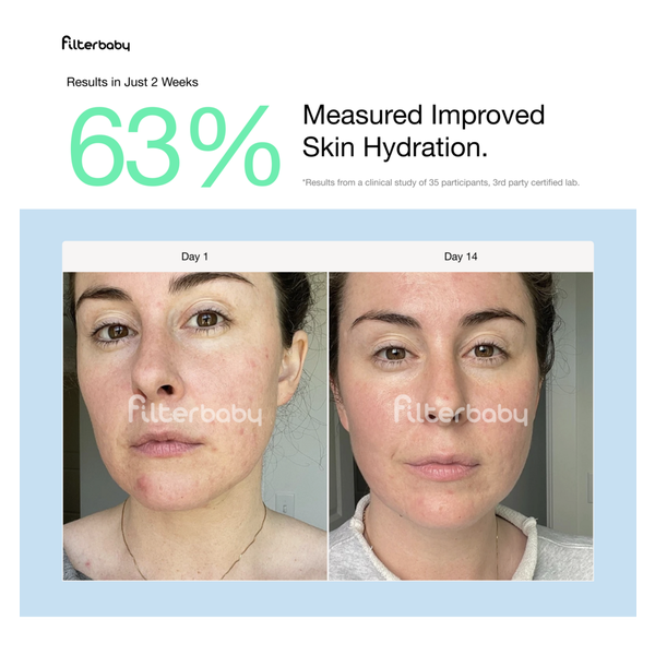 FilterBaby Skincare Water Filter 2.0 + 2 Filter Refills #6