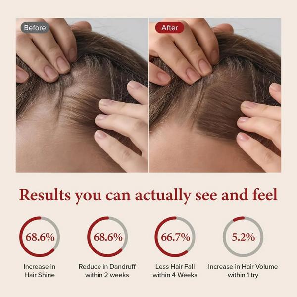 KUNDAL Caffeine Scalp Care Shampoo #5