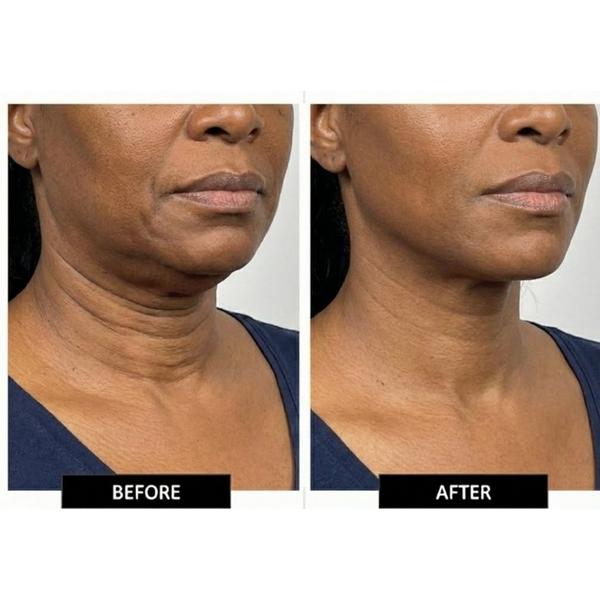 LuminaNRG Feather Neck & Decollete LED Mask #5