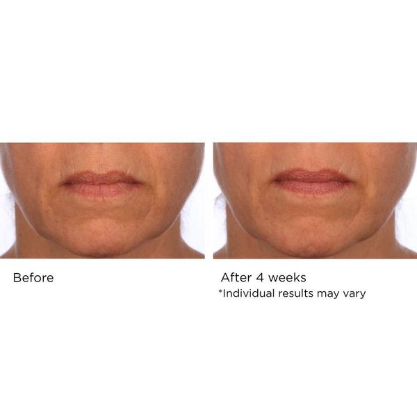 NassifMD Skincare Pure Hydration Night Cream #8