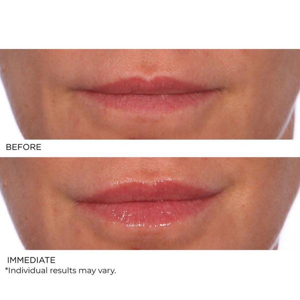 NassifMD Skincare Hydro-Screen Lip Plumper #3