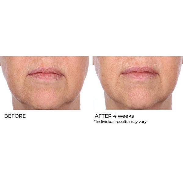 NassifMD Skincare Skin Barrier Protection Cream #7