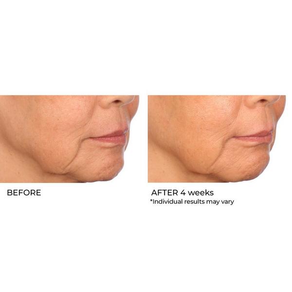 NassifMD Skincare Skin Barrier Protection Cream #9