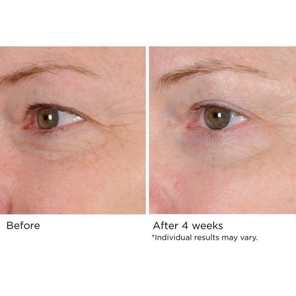 NassifMD Skincare Peri-Orbital Eye Complex #4