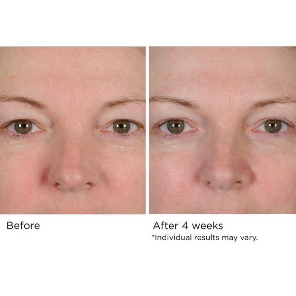 NassifMD Skincare Peri-Orbital Eye Complex #6
