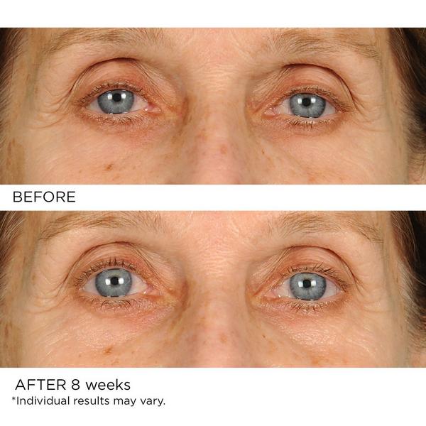 NassifMD Skincare Anti-Aging Undereye Smoother #4