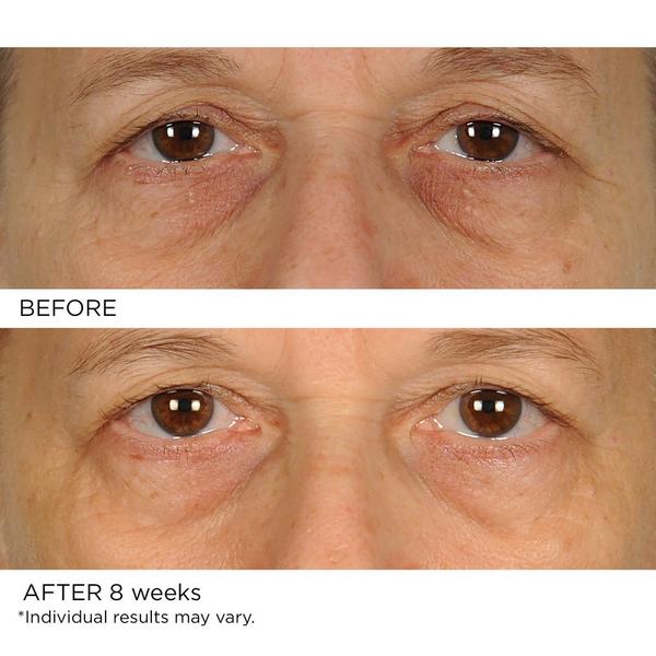 NassifMD Skincare Anti-Aging Undereye Smoother #5