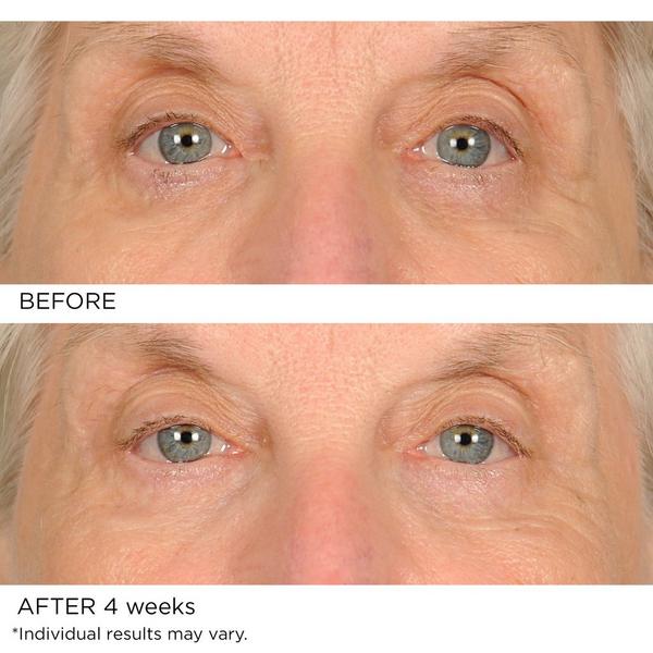 NassifMD Skincare Anti-Aging Undereye Smoother #6