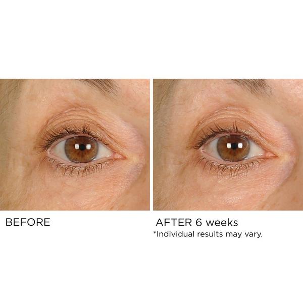 NassifMD Skincare Anti-Aging Undereye Smoother #8