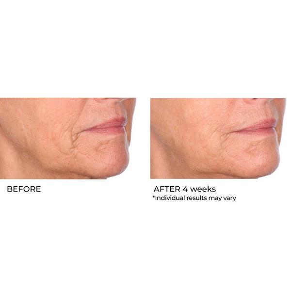 NassifMD Skincare Niacinamide Biopeptide Serum #6