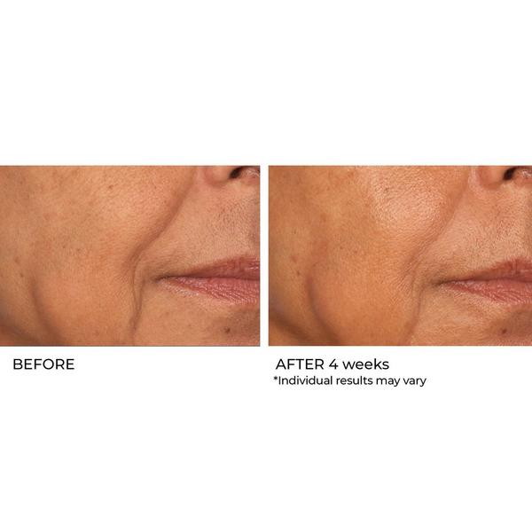 NassifMD Skincare Niacinamide Biopeptide Serum #8