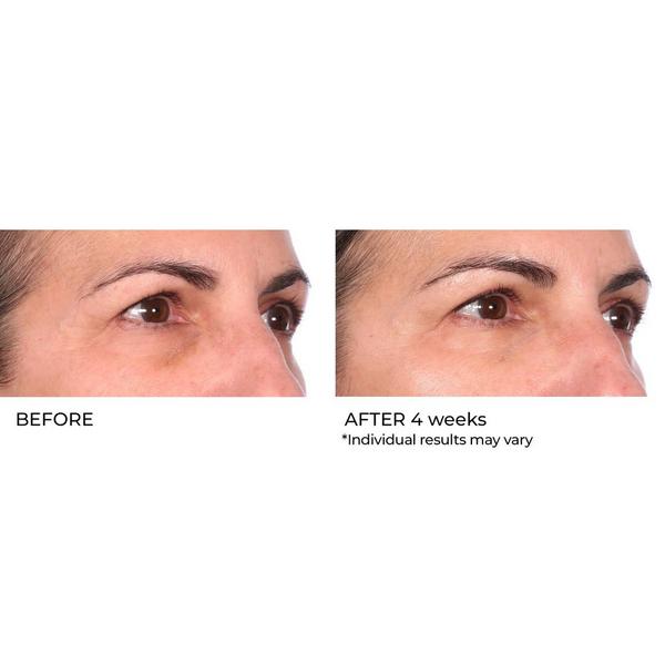 NassifMD Skincare Niacinamide Biopeptide Serum #4