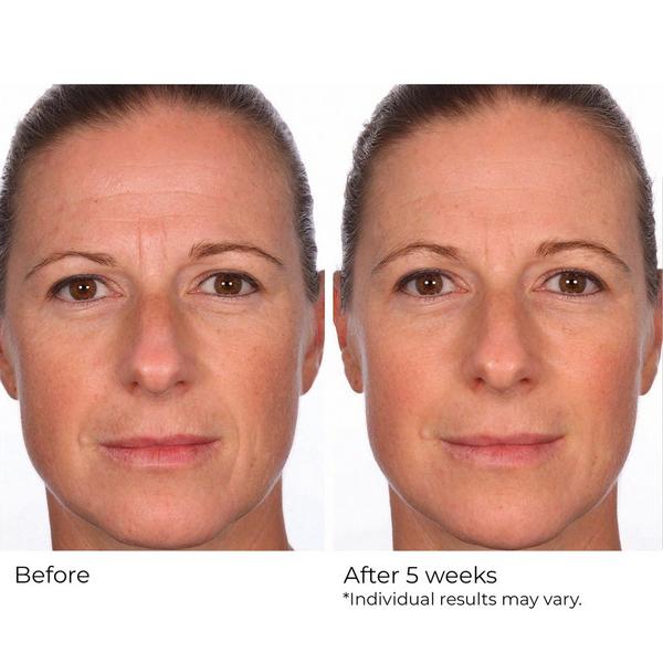 NassifMD Skincare Hydro-Screen Serum #5