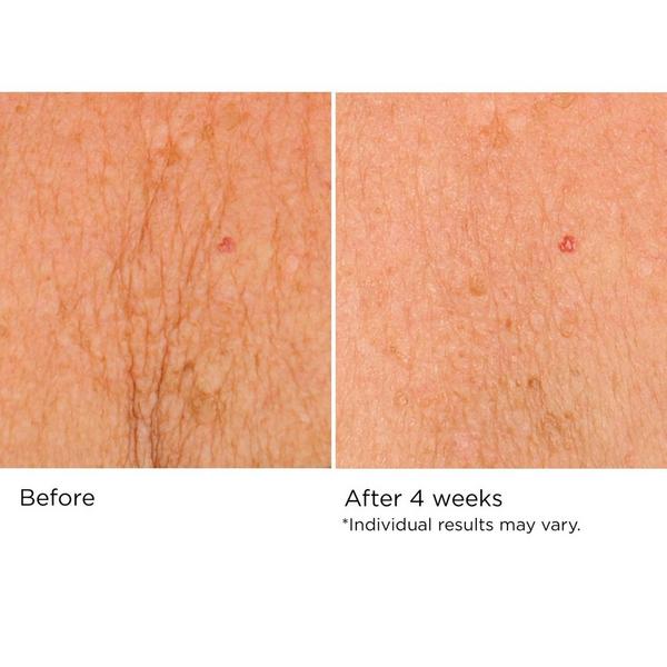 NassifMD Skincare Deco-Lift Neck & Decollete Firming & Lifting Complex #5