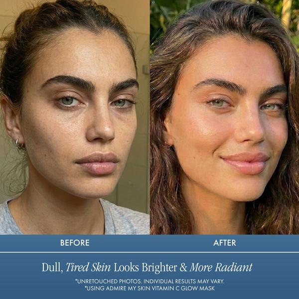 Admire My Skin Vitamin C Glow Mask for Brightening - Contains Glycolic and Lactic Acids #3