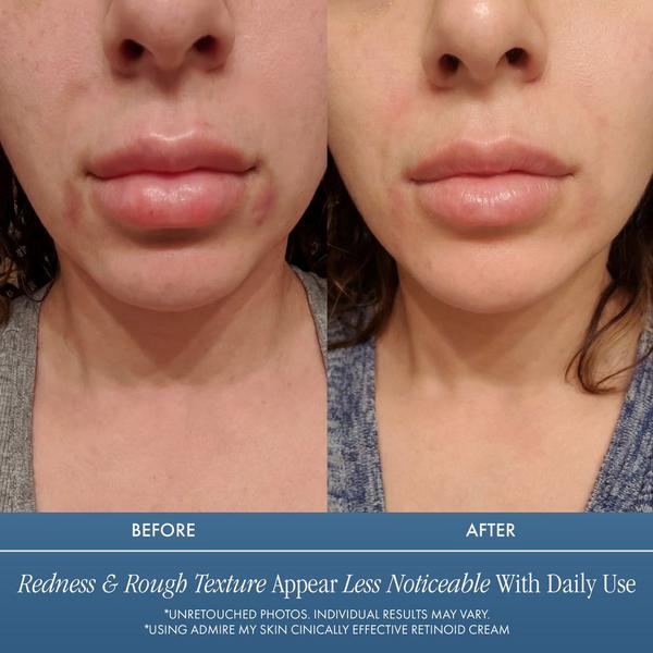 Admire My Skin Clinical Effective Retinoid Cream for Anti Aging Anti Wrinkle Skincare #5