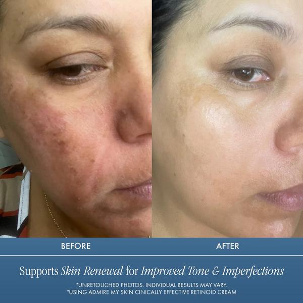 Admire My Skin Clinical Effective Retinoid Cream for Anti Aging Anti Wrinkle Skincare #6