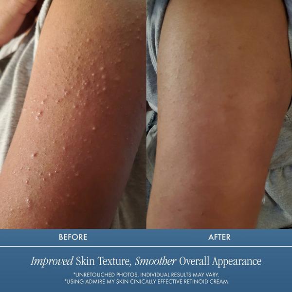 Admire My Skin Clinical Effective Retinoid Cream for Anti Aging Anti Wrinkle Skincare #7