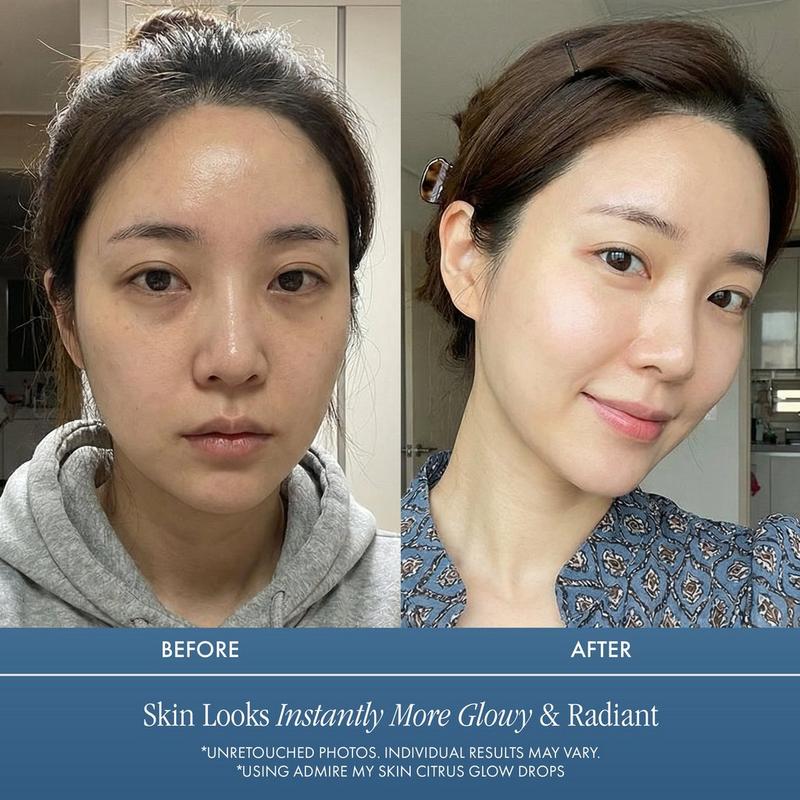 dmso vitamin c glutathione eye drops Perfluorohexyloctane (NOV03) | Anti-Dry Eye Disease Agent