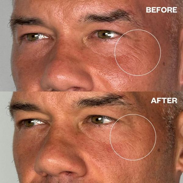 Wrinkles Schminkles Men's Pro Eye Wrinkle Patches #4
