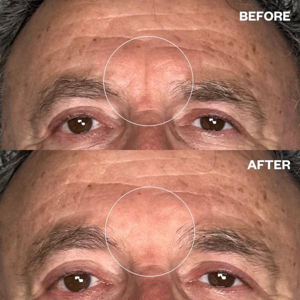 Wrinkles Schminkles Men's Pro Eye & Forehead Bundle #7