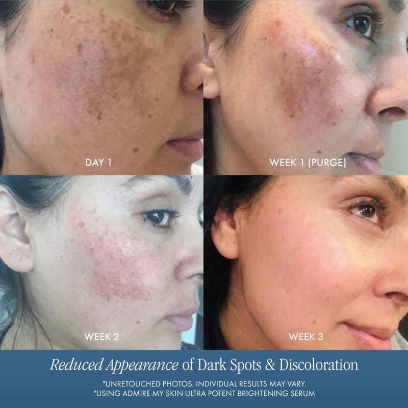 Admire My Skin - Ultra Potent Brightening Serum Dark Spot