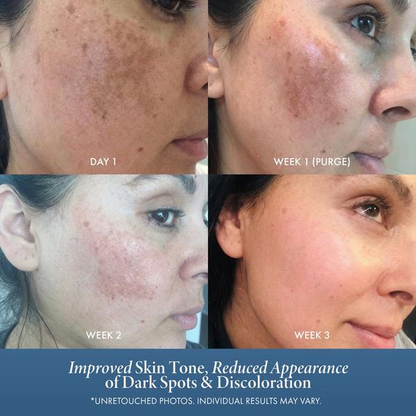 Admire My Skin Ultra Potent Brightening Serum Dark Spot Corrector #5