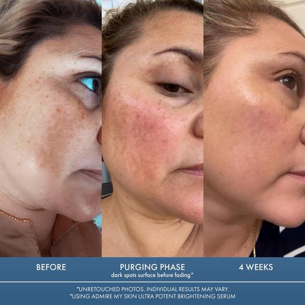 Admire My Skin Ultra Potent Brightening Serum Dark Spot Corrector #6