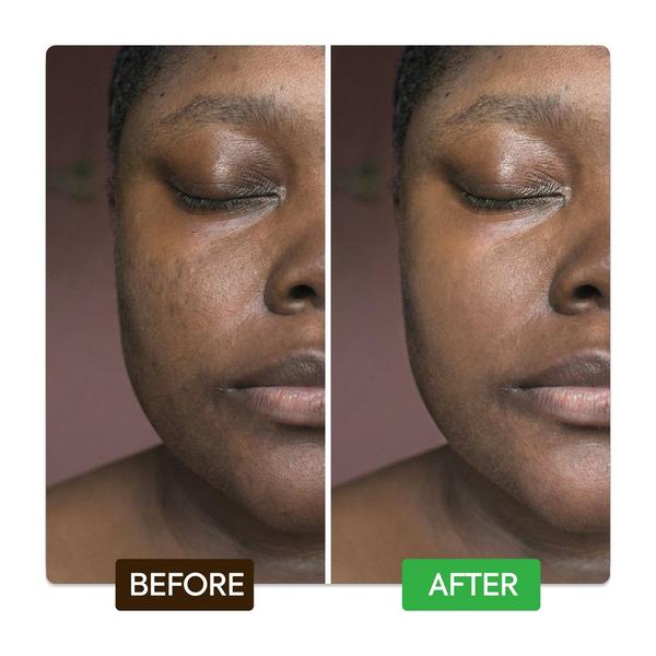 Makari Kojic & Azelaic Brightening Serum #6