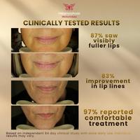 Metamorphosis LushLips Transformation Red Light Therapy Lip+Perioral Rejuvenation System #6