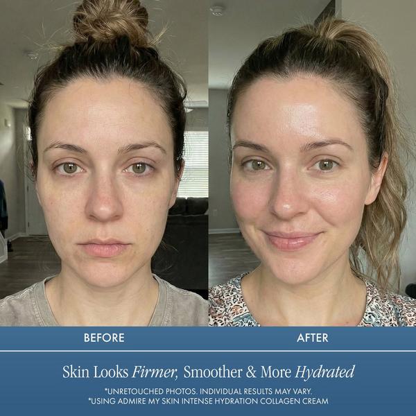 Admire My Skin Intense Hydration Collagen Cream #5