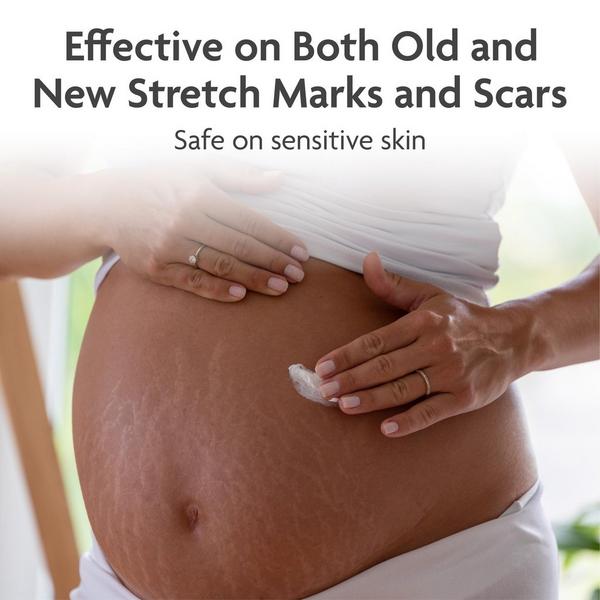 Trilastin Maximum Strength Treatment Stretch Mark Cream #6