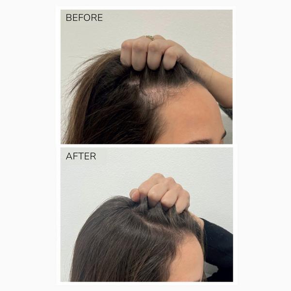 Moncho Moreno Rapunhair Growth Serum #3