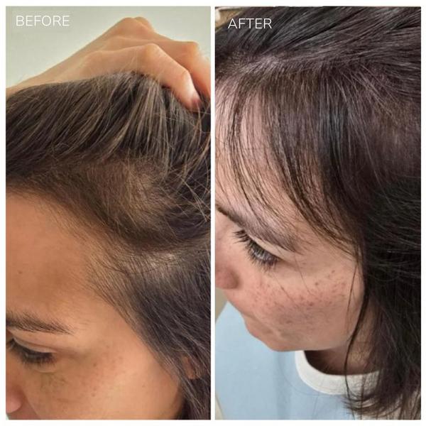 Moncho Moreno Rapunhair Growth Serum #5