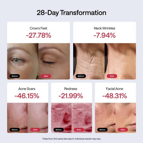 Ulike JMOON FlexGlow Panel Light #5