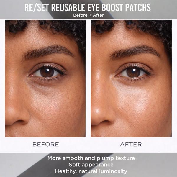 NOTO Botanics Re/Set Reusable Eye Boost 100% Silicone Patches #6