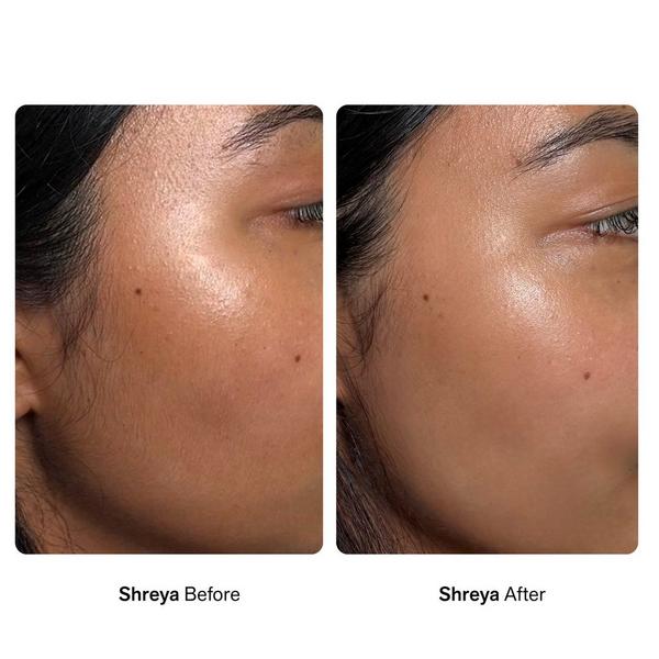 Nimbi Pillow Slip Dermaplaner Facial Oil #7